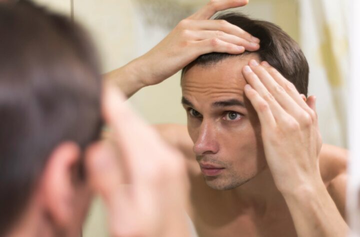 Hair transplant in Coimbatore , Best hair transplant clinic in Coimbatore , Bio-FUE hair transplant Coimbatore , Sapphire FUE hair transplant Tamil Nadu , DHI hair transplant cost Coimbatore , Keva Ha